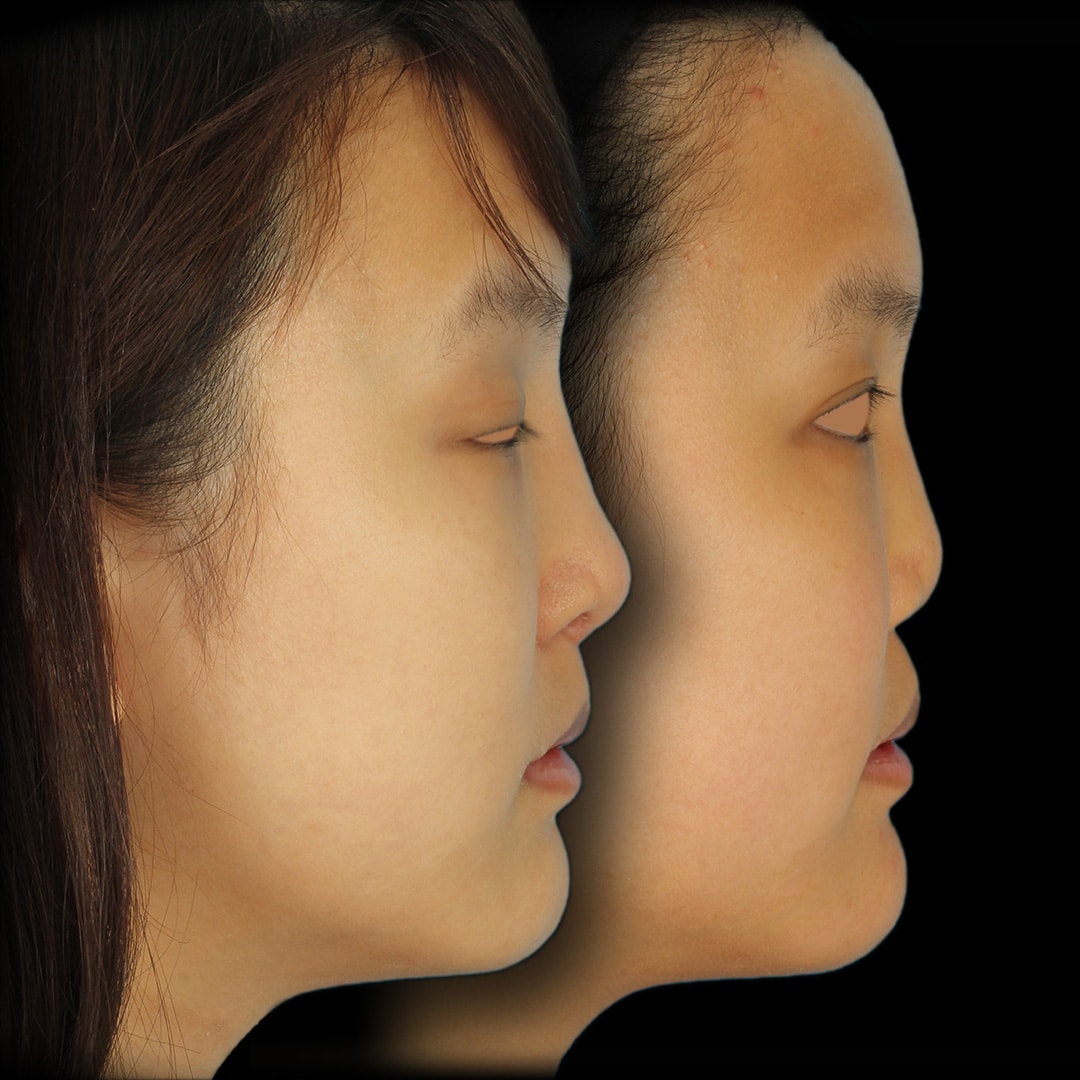 Patient who undergone plastic surgery for reasons beyond aesthetics