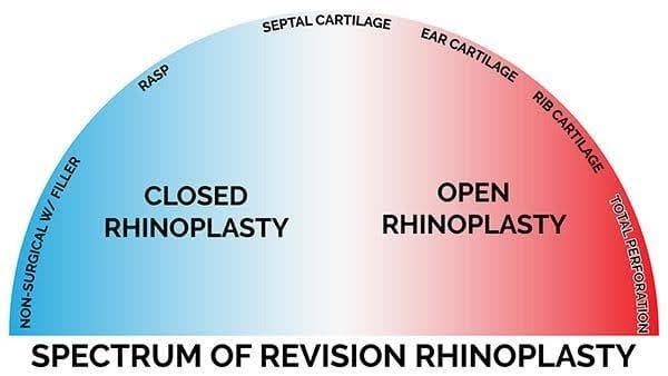 spectrum rhinplasty